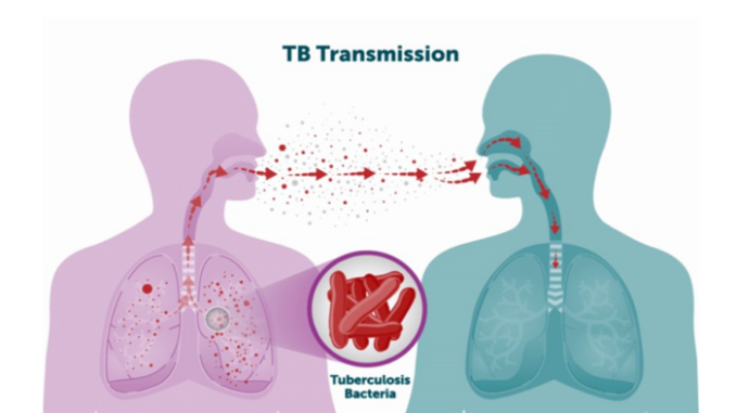 TB transmission